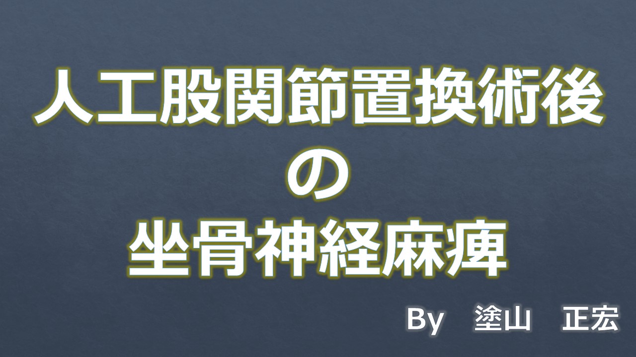 坐骨神経麻痺